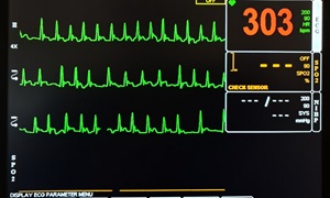 Patient Monitoring