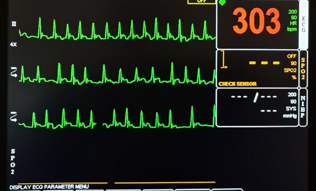 Patient Monitoring