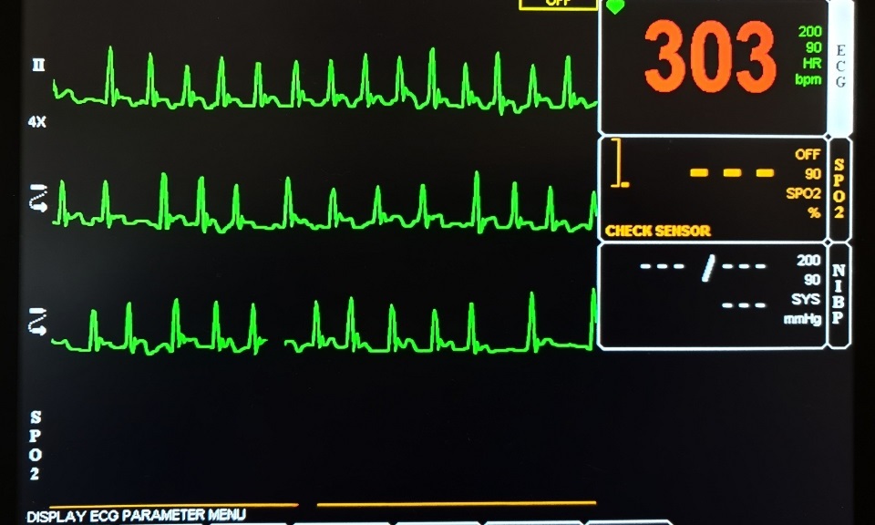 Patient Monitoring