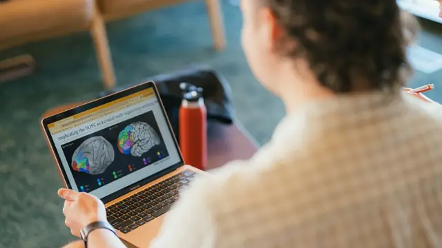 Allied health student reviewing a brain scan on a laptop